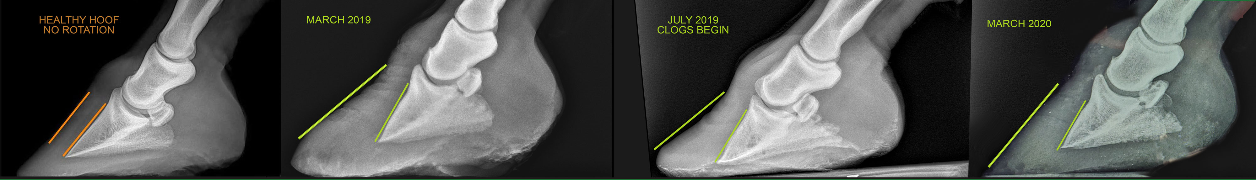 ANI-HOOF-XRAY-COMPARISON